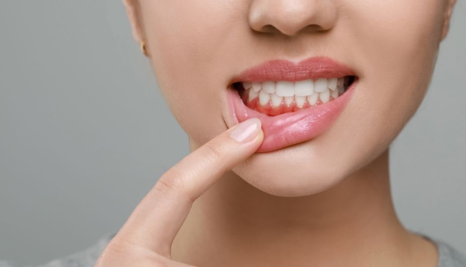 Gum Disease