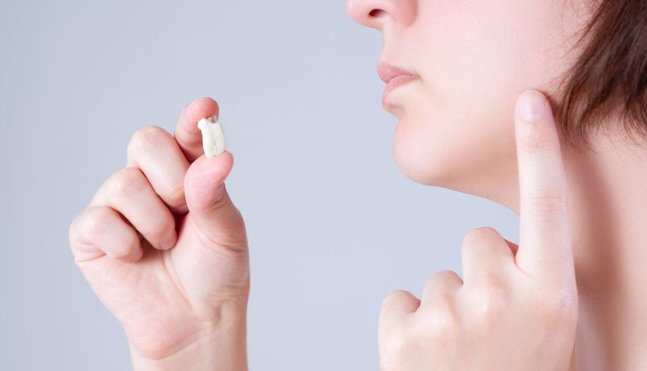 Wisdom Teeth Extraction